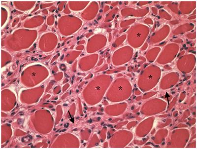 Spinal Muscular Atrophy in Blonde D'Aquitaine Calves Is Not Associated With FVT1 Gene Mutation